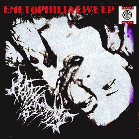 Nephrectomy : Emetophilia Live EP
